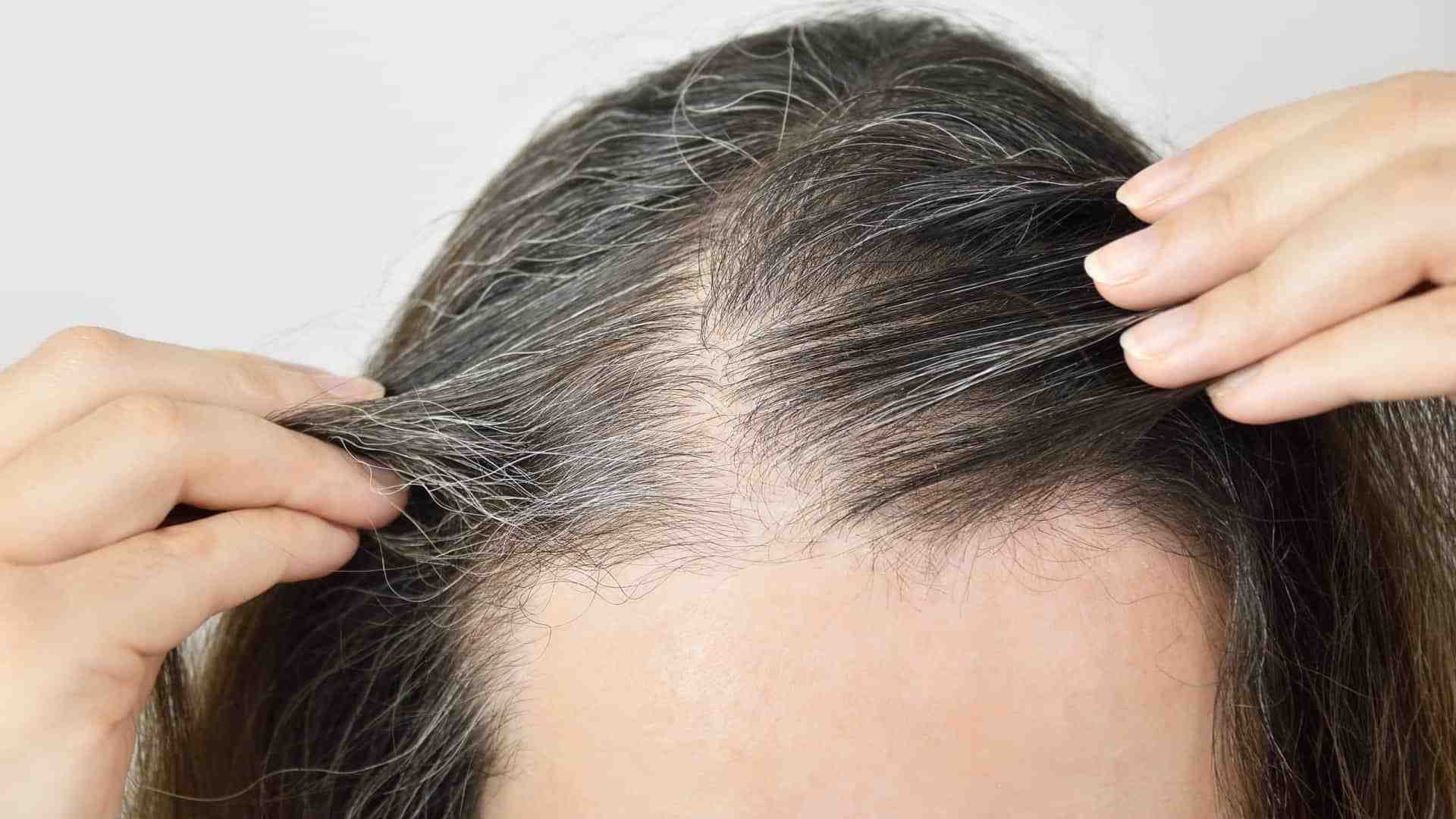 Descubra como eliminar cabelos grisalhos naturalmente
