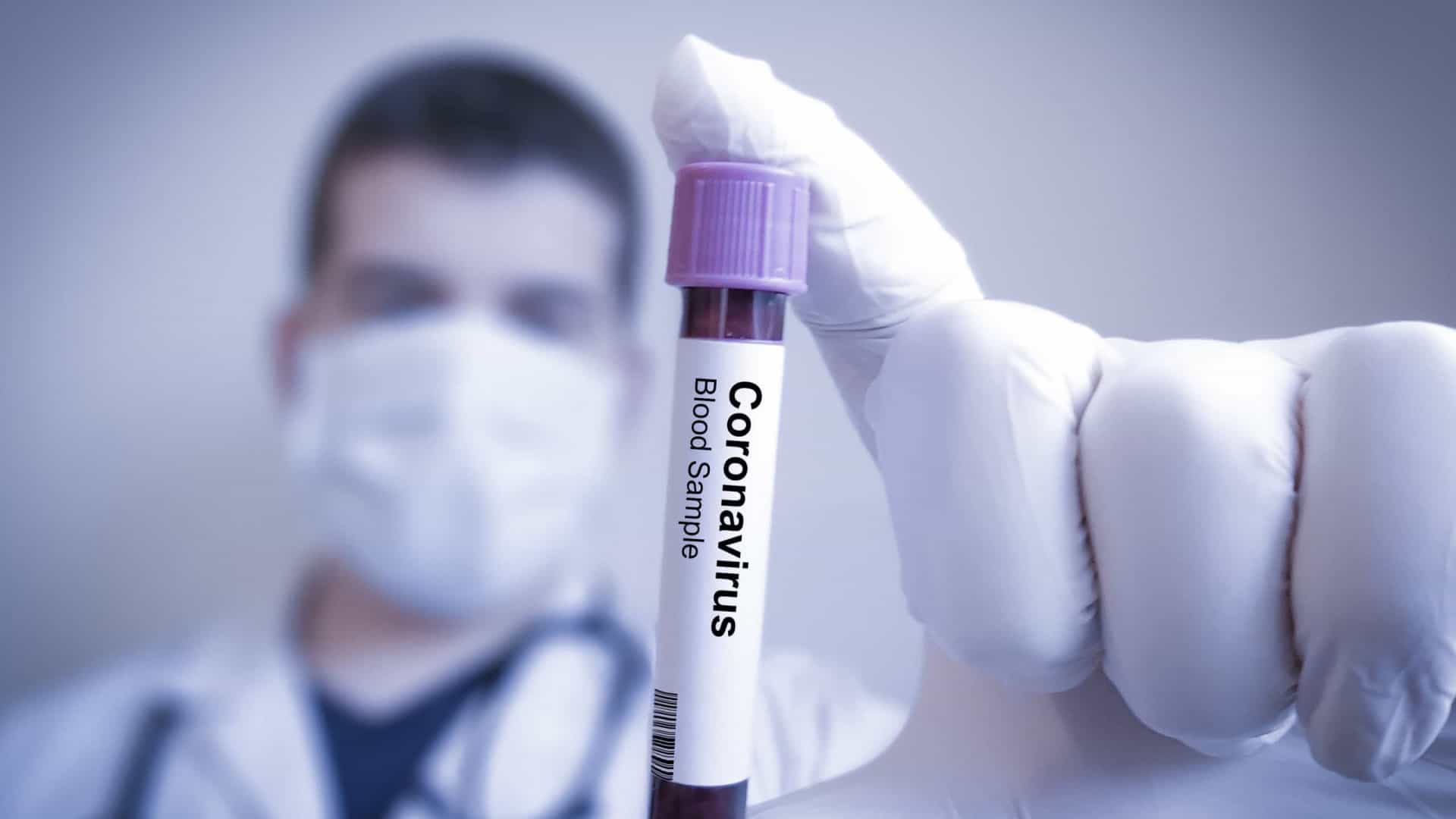 Cientistas alertam que o coronavírus é transmitido pelo ar e pedem mudanças na OMS | © Shutterstock