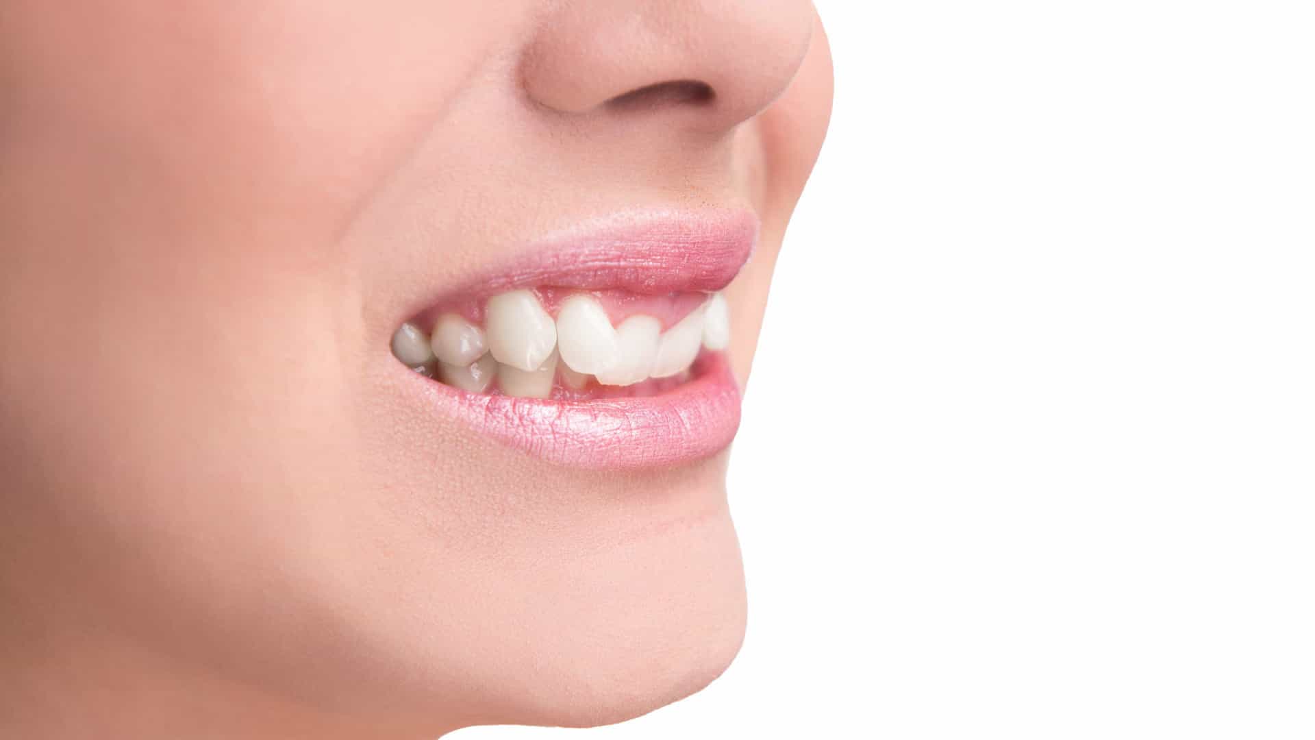 4 maneiras de remover o tártaro dos dentes naturalmente