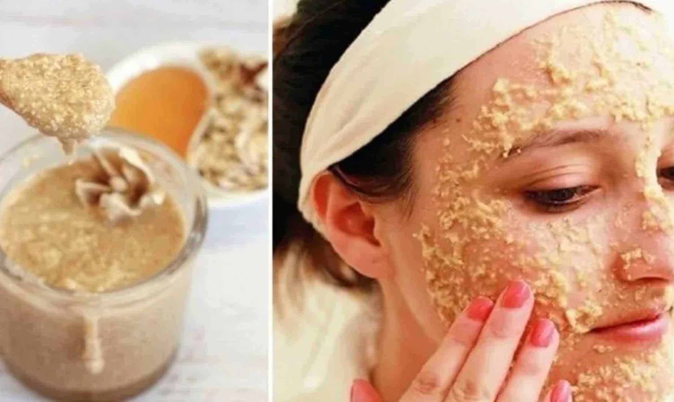 É fácil: Máscara de aveia e mel para controlar a acne