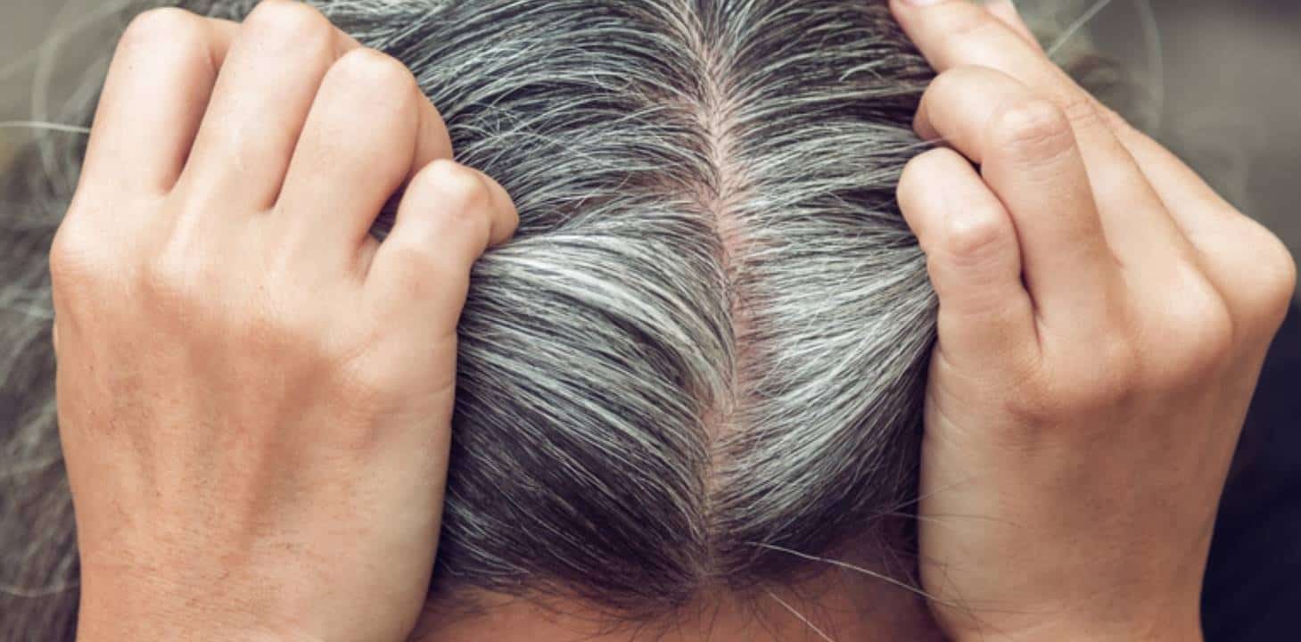 Dicas essenciais para prevenir o aparecimento de cabelos grisalhos