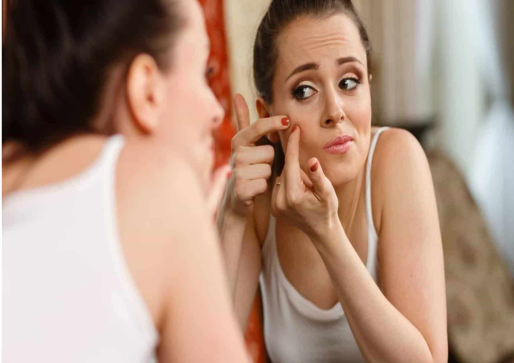 Aprenda 8 remédios caseiros para remover espinhas do rosto