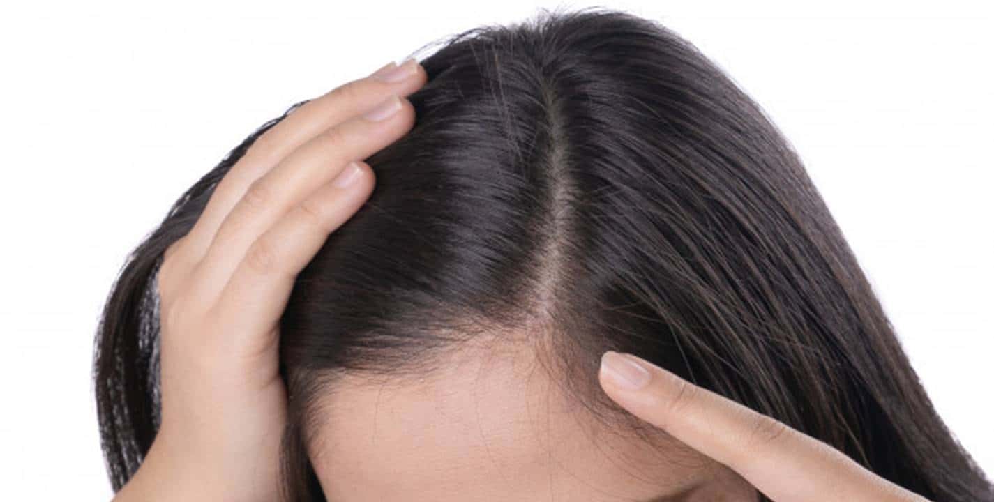 Remédios caseiros para reduzir os cabelos grisalhos