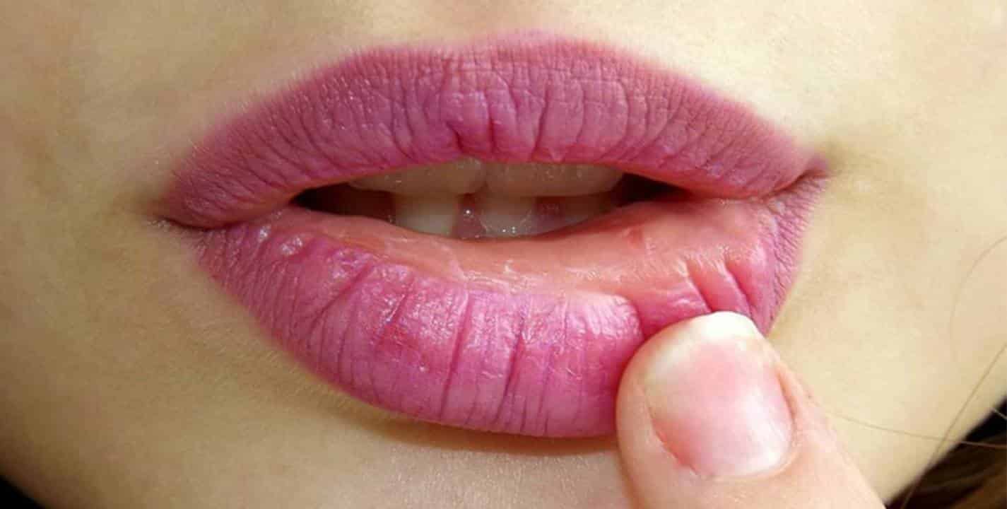 Aprenda como evitar lábios secos e os ingredientes naturais para hidratá-los
