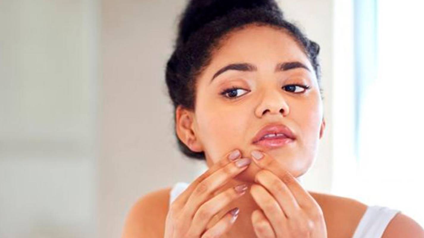 Conheça os óleos naturais que te ajudarão a ter um rosto sem acne